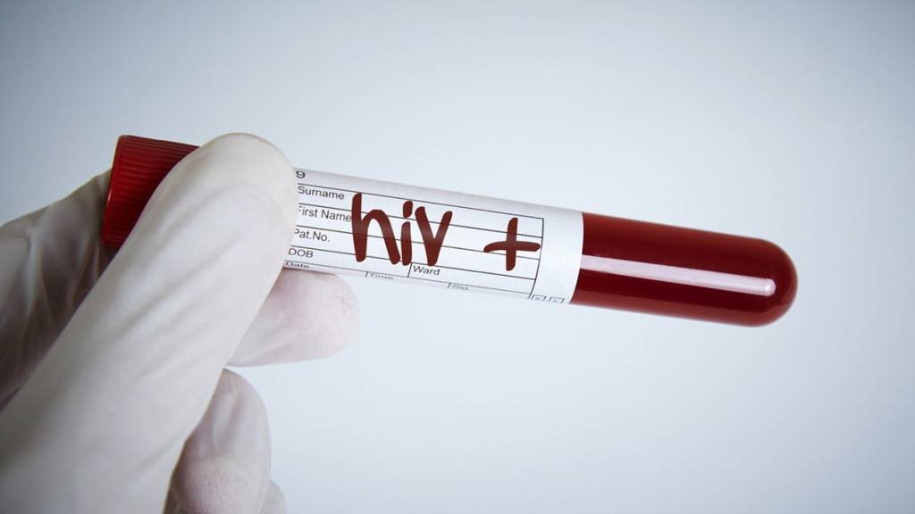本港第3季愛滋病增97宗 1人因注射毒品感染